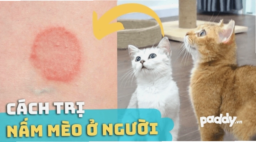 Biểu hiện của bệnh nấm mèo ở người gây ngứa rát da