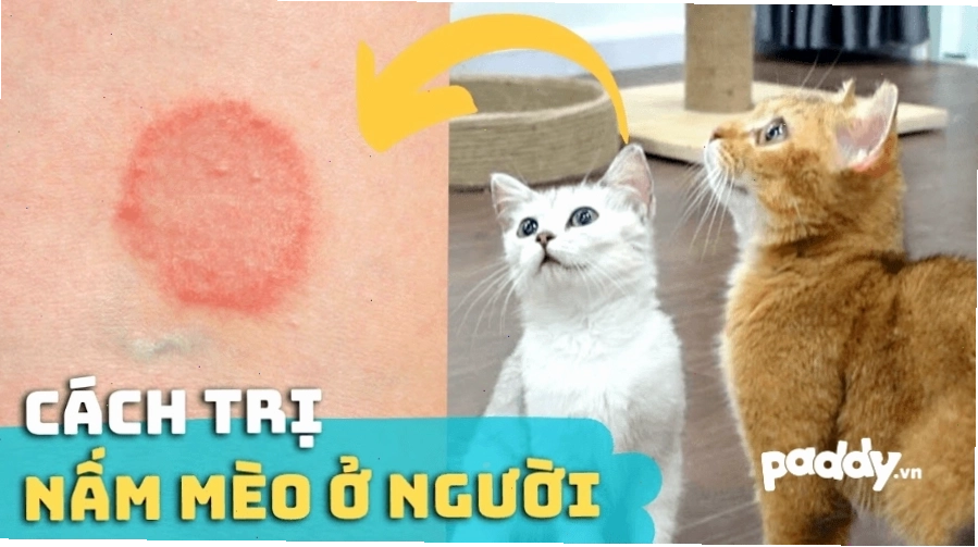Biểu hiện của bệnh nấm mèo ở người với các mảng đỏ, có vảy