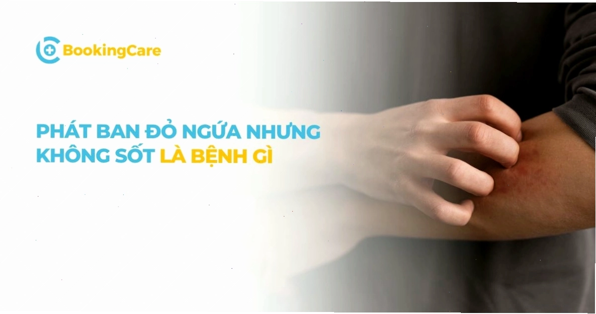 Biểu hiện của phát ban đỏ ngứa trên da nhưng không kèm theo sốt