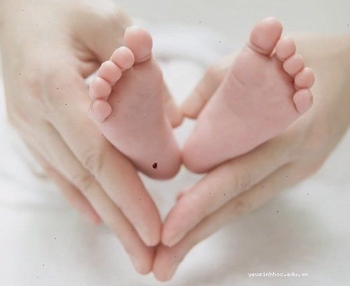 Các bệnh có thể được phát hiện qua xét nghiệm lấy máu gót chân trẻ sơ sinh