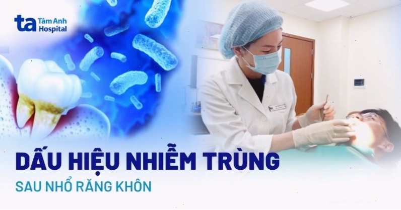 Các dấu hiệu nhiễm trùng sau khi nhổ răng khôn