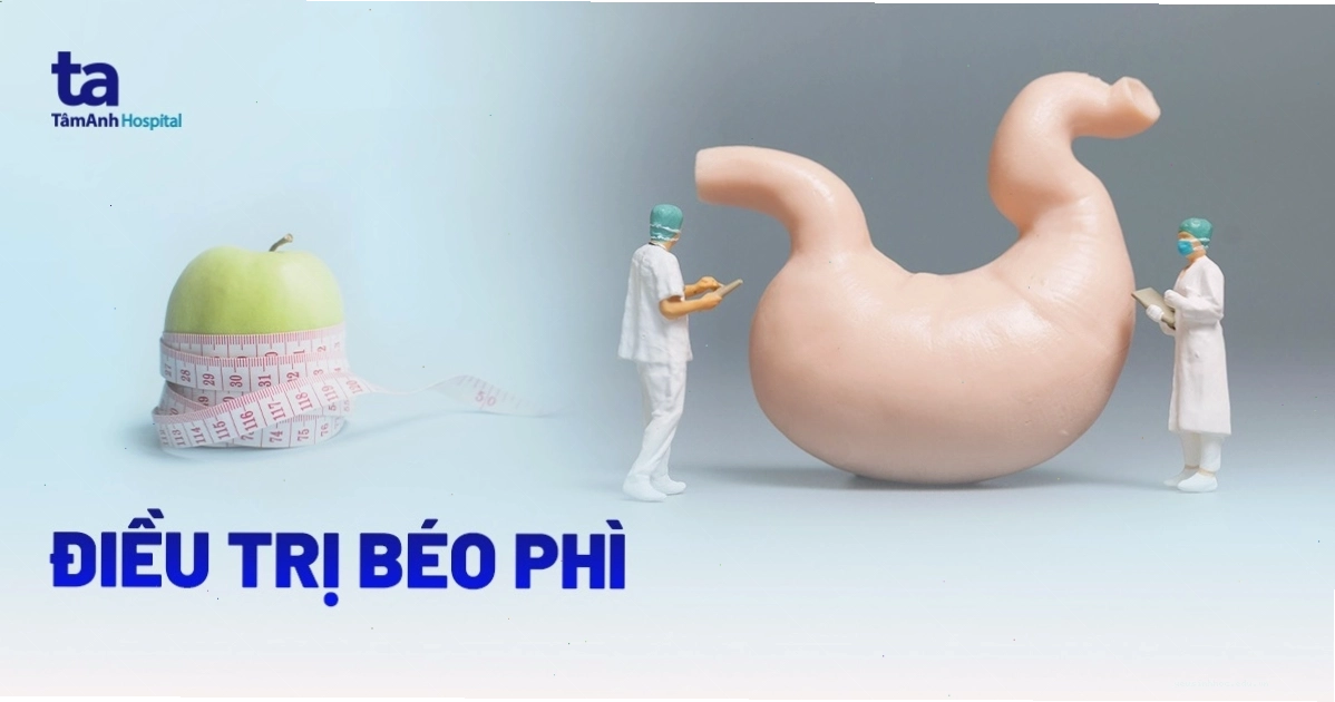 Các phương pháp điều trị béo phì hiệu quả