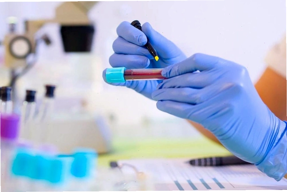 Các xét nghiệm chẩn đoán đề kháng insulin