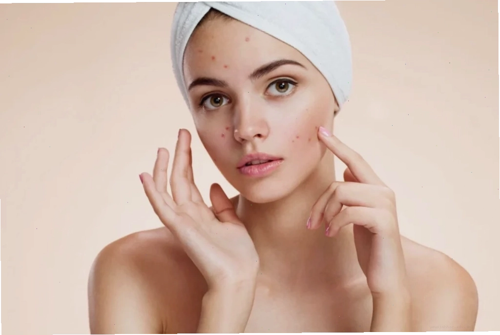 Cách điều trị mụn nhọt hiệu quả để hạn chế sẹo
