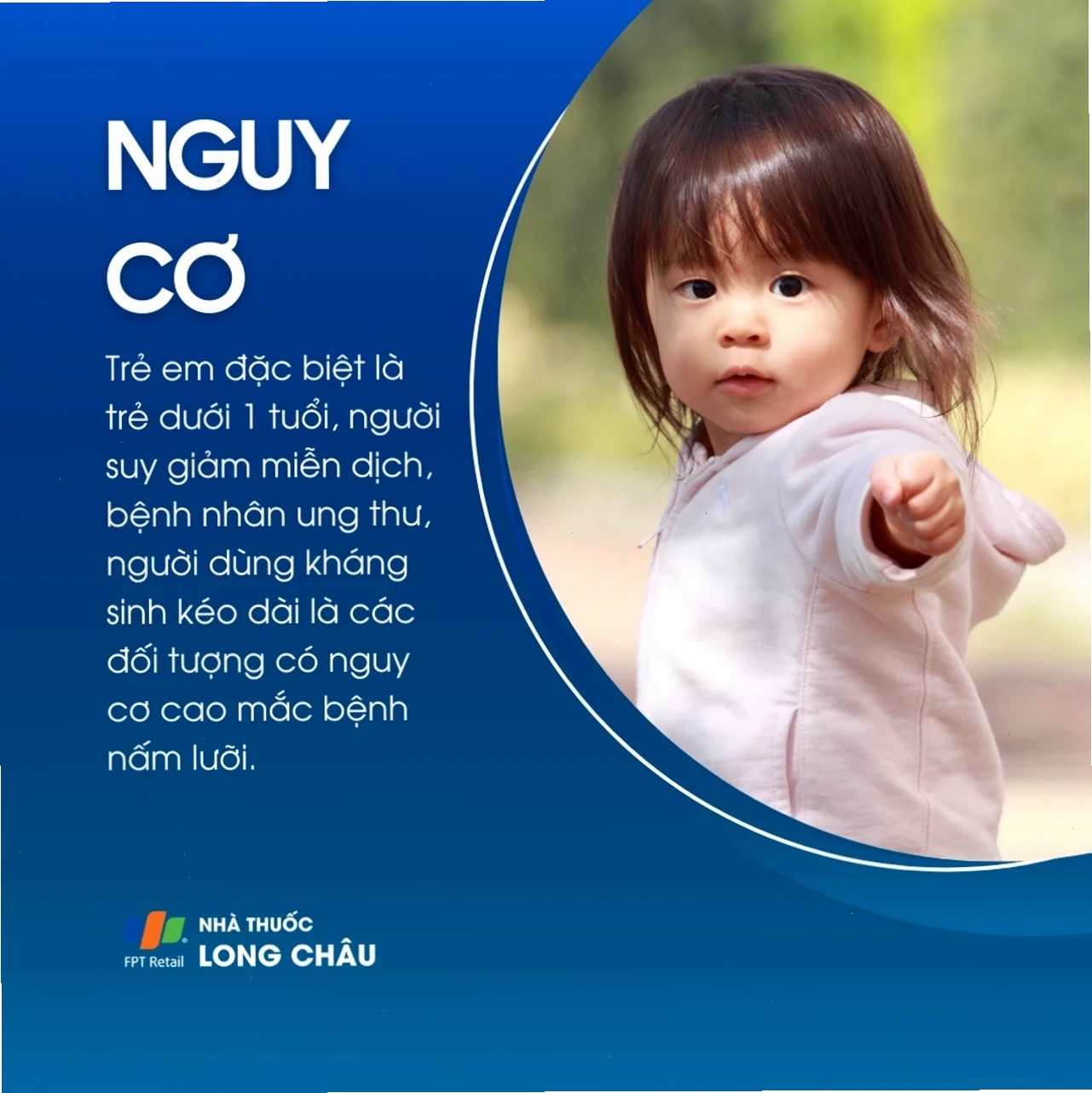 Cận cảnh lưỡi bị nấm với các mảng trắng và đỏ