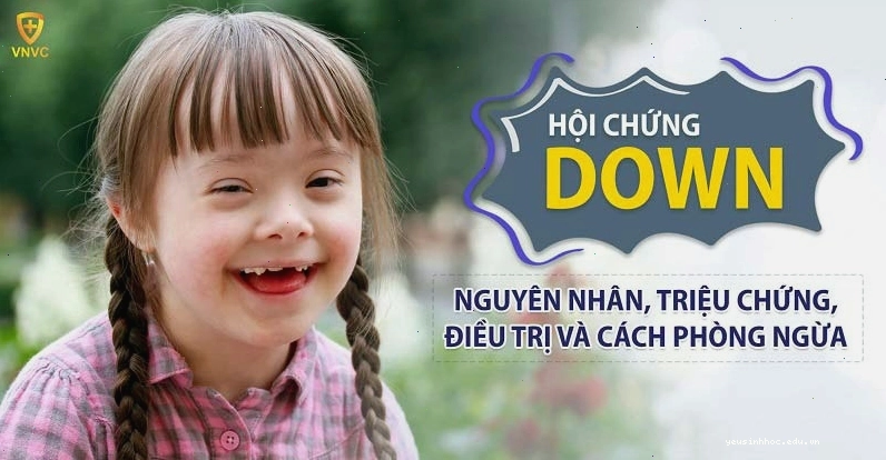 Chăm sóc trẻ mắc hội chứng Down