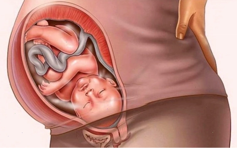Chimerism do hấp thụ tế bào trong quá trình mang thai