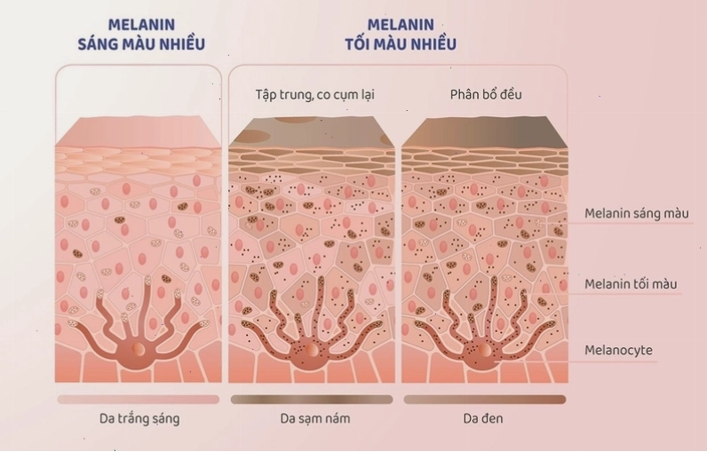 Cơ chế hình thành melanin trong tế bào hắc tố