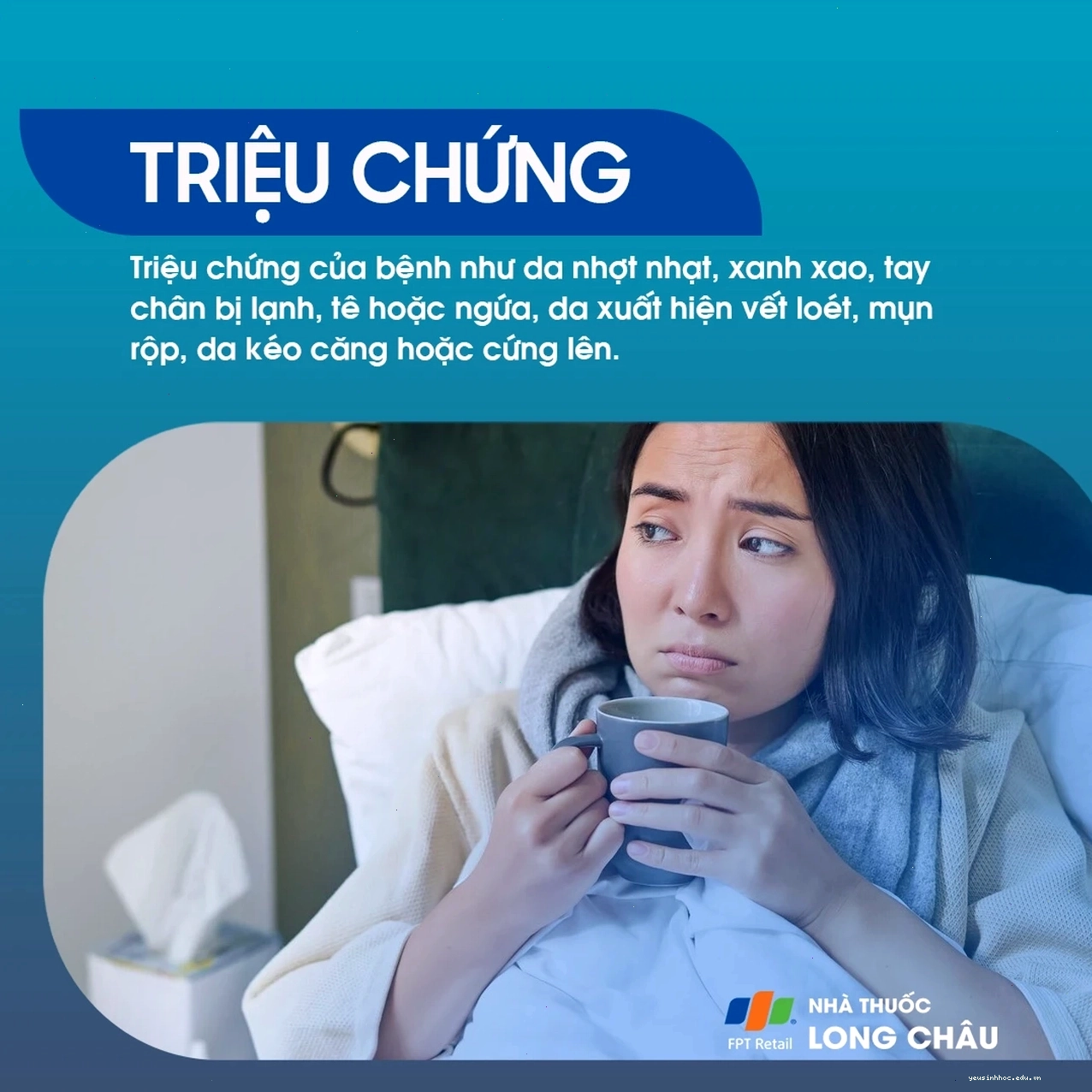 Da chân, tay nhợt nhạt, xanh xao là dấu hiệu của người chân tay lạnh
