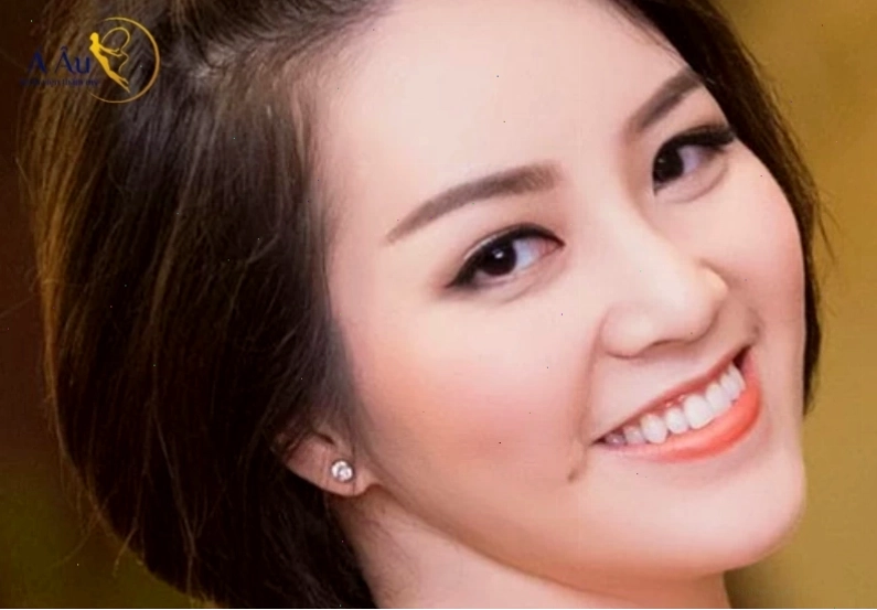 Đặc điểm má lúm đồng điếu bên phải