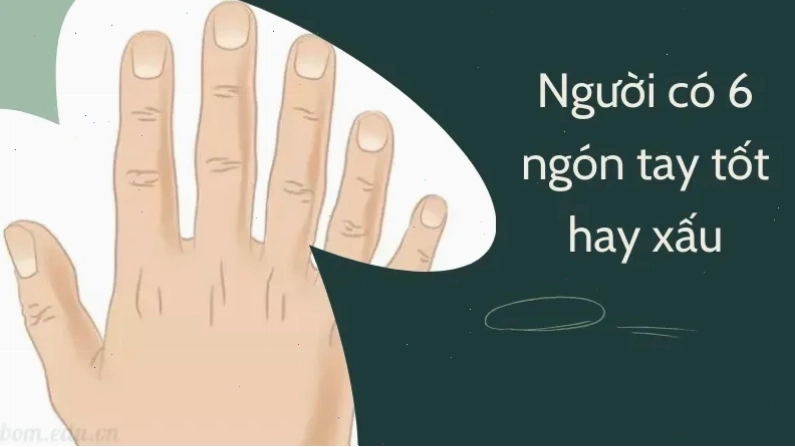 Đánh giá người có 6 ngón tay tốt hay xấu