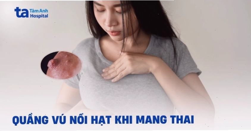 Đầu nhũ hoa có hạt trắng khi mang thai