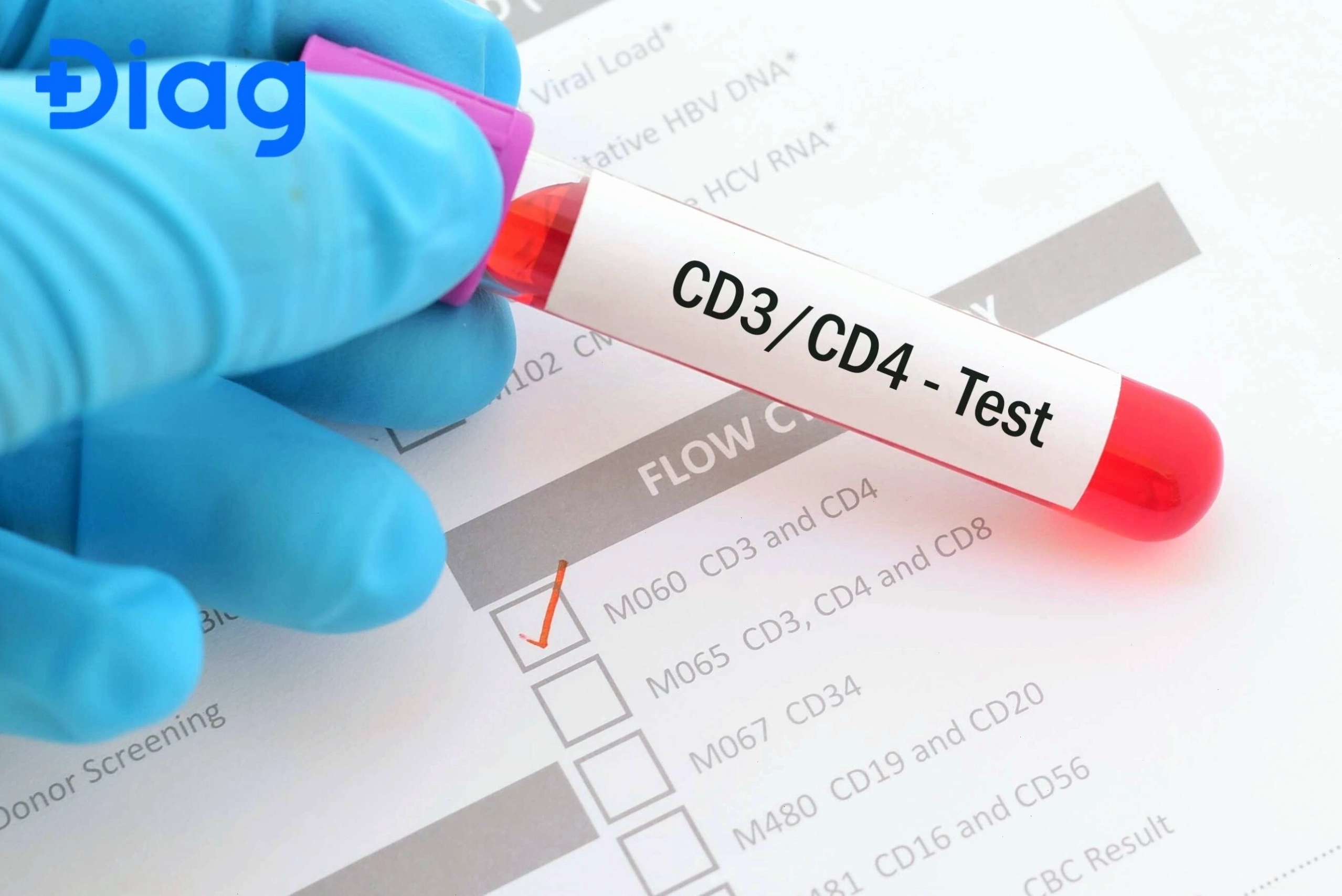 Đếm tế bào CD4 bằng phương pháp miễn dịch