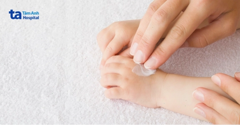 Điều trị ghẻ phỏng bằng thuốc bôi ngoài da theo đơn của bác sĩ