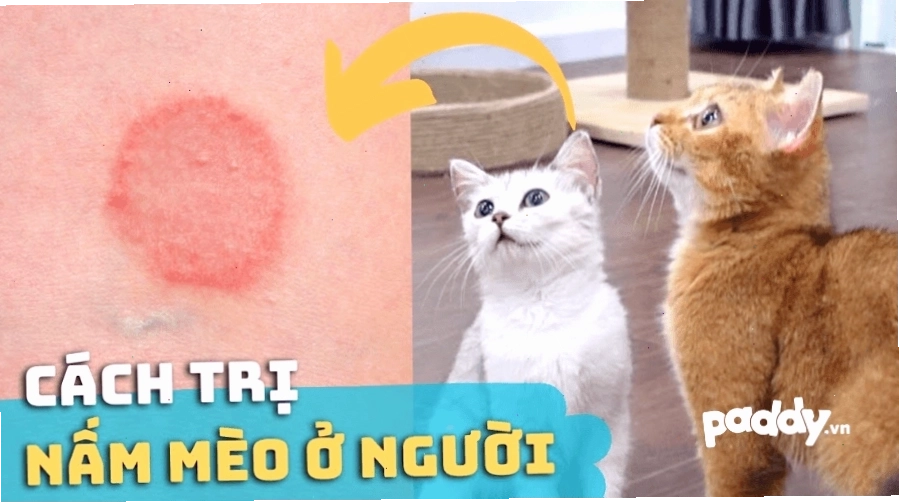 Điều Trị Nấm Mèo Ở Người An Toàn