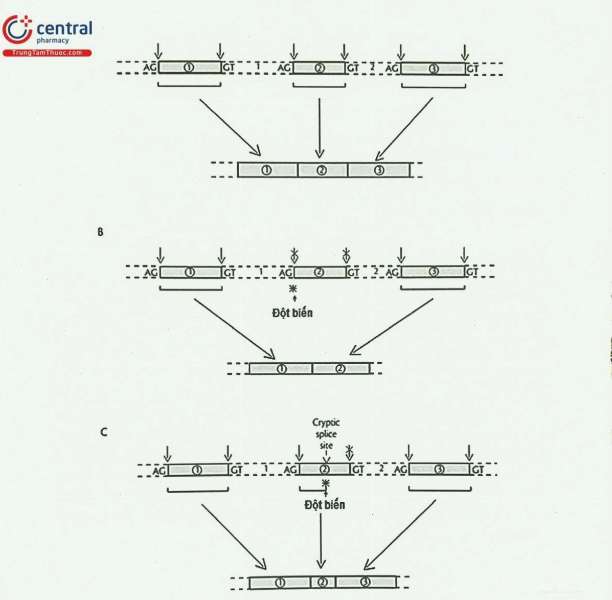 Đột biến ảnh hưởng đến quá trình splicing RNA