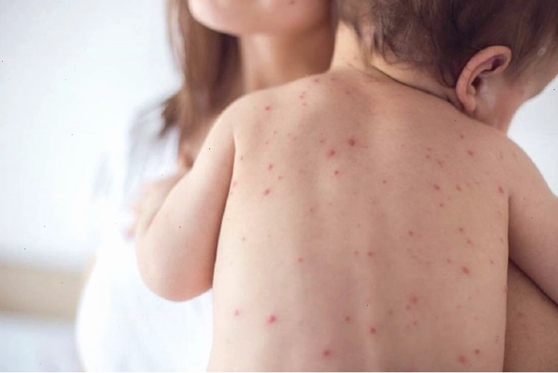 Đưa trẻ đến cơ sở y tế gần nhất để khám và điều trị