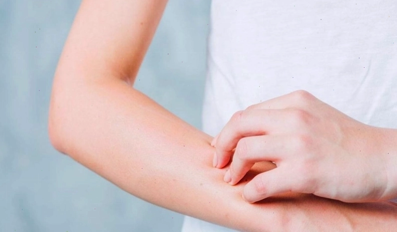 Giải mã tình trạng người hay bị ngứa khắp người không rõ nguyên nhân