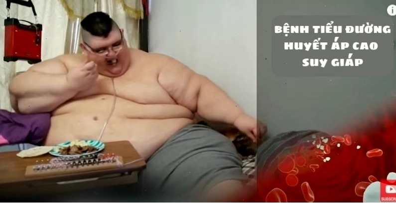 Hậu quả sức khỏe của béo phì cực đoan