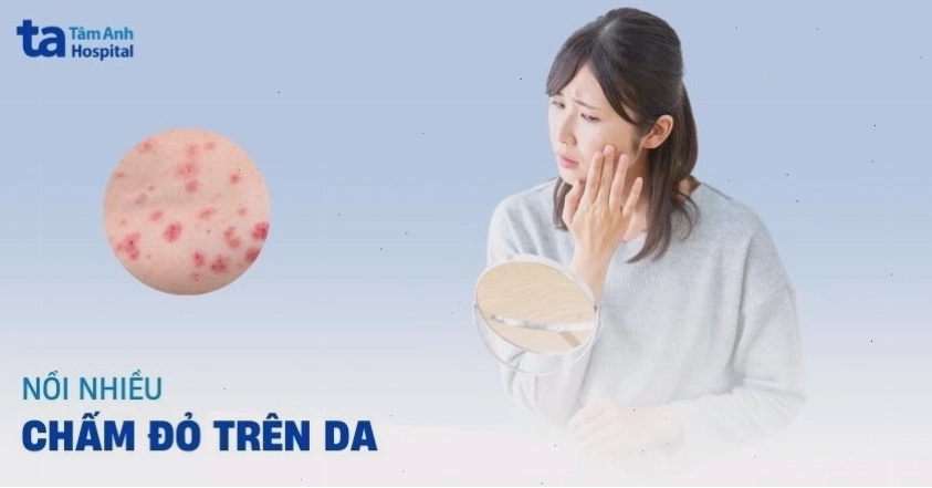 Hình ảnh minh họa các nốt đỏ nhỏ li ti xuất hiện trên da người