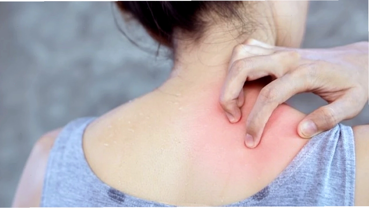 Hình ảnh minh họa người bị tiểu đường với làn da khô ráp và dấu hiệu ngứa