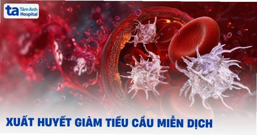 Hình ảnh minh họa người bị xuất huyết giảm tiểu cầu miễn dịch với các mảng bầm tím trên da