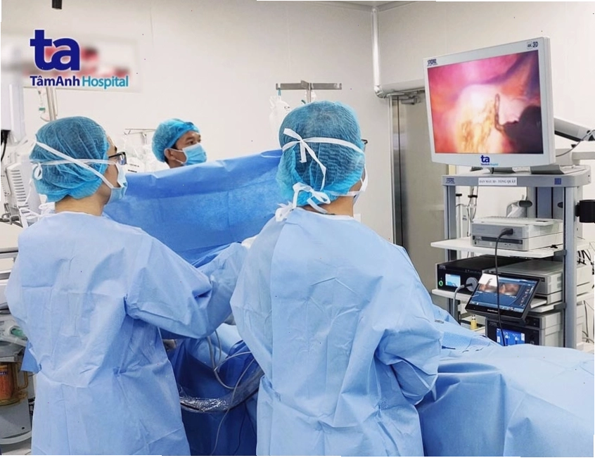 Hình ảnh minh họa phẫu thuật cắt hạch giao cảm
