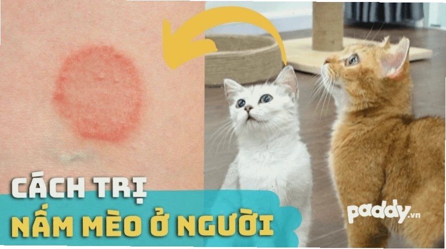 Hình ảnh minh họa triệu chứng nấm mèo ở người