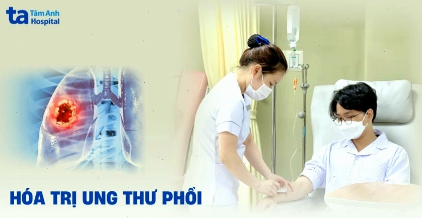 Hóa trị ung thư phổi