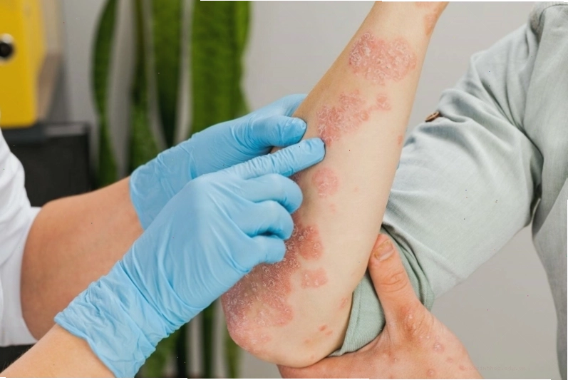 Kem bôi trị ngứa giúp làm dịu da