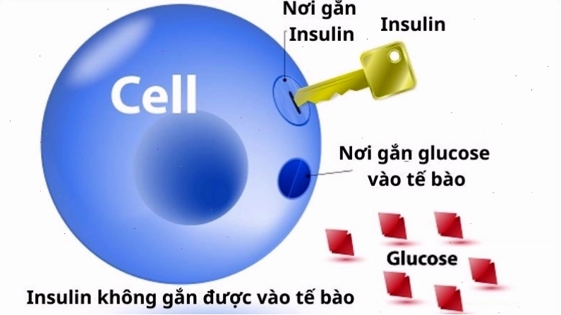 Kháng insulin là nguyên nhân chính gây bệnh gai đen ở người béo phì