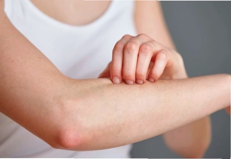 Không nên gãi khi bị ngứa để tránh làm tổn thương da