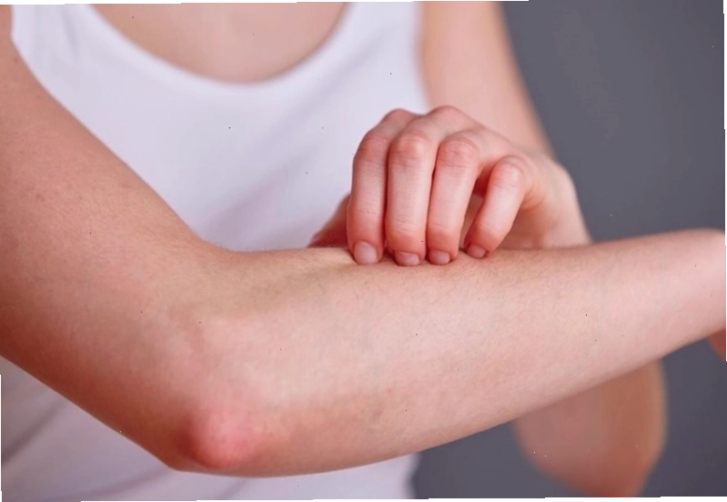 Không nên gãi mạnh khi bị ngứa