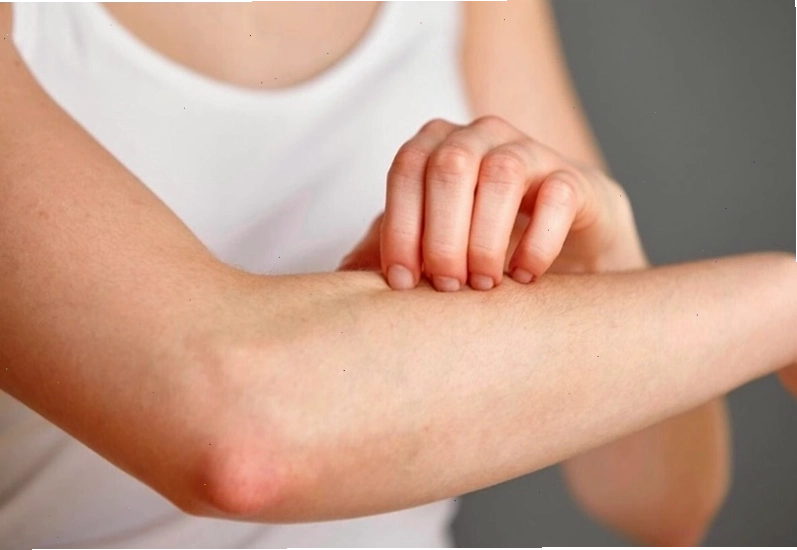 Không nên gãi mạnh khi bị ngứa để tránh làm tổn thương da