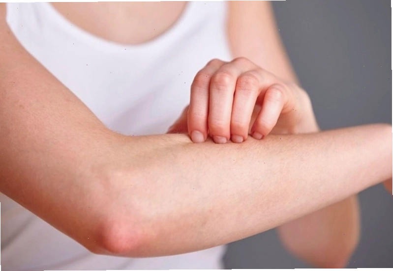 Không nên gãi nhiều để tránh tổn thương cho da