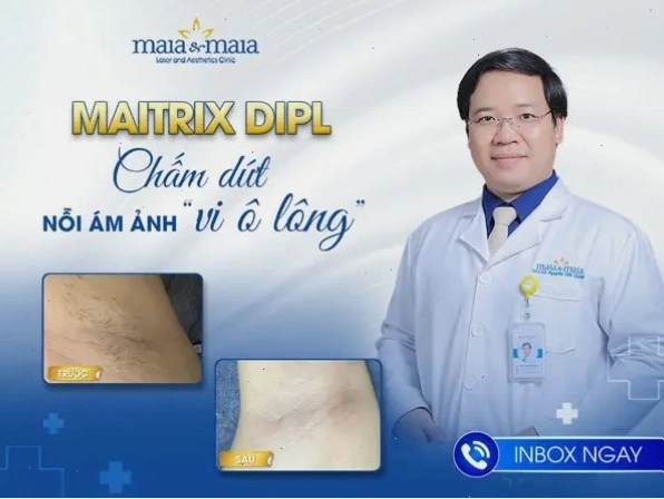 Kỹ thuật triệt lông Maitrix DiPL hiện đại