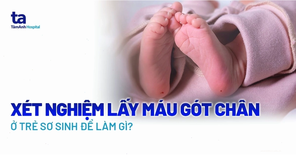 Lưu ý sau khi thực hiện lấy máu gót chân cho trẻ sơ sinh