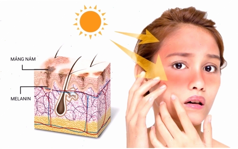 Melanin được vận chuyển đến các tế bào da xung quanh