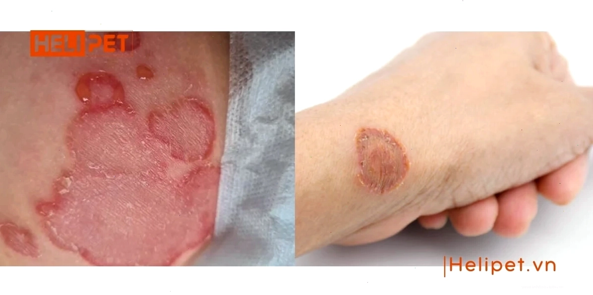 Mèo bị nấm có thể lây sang người