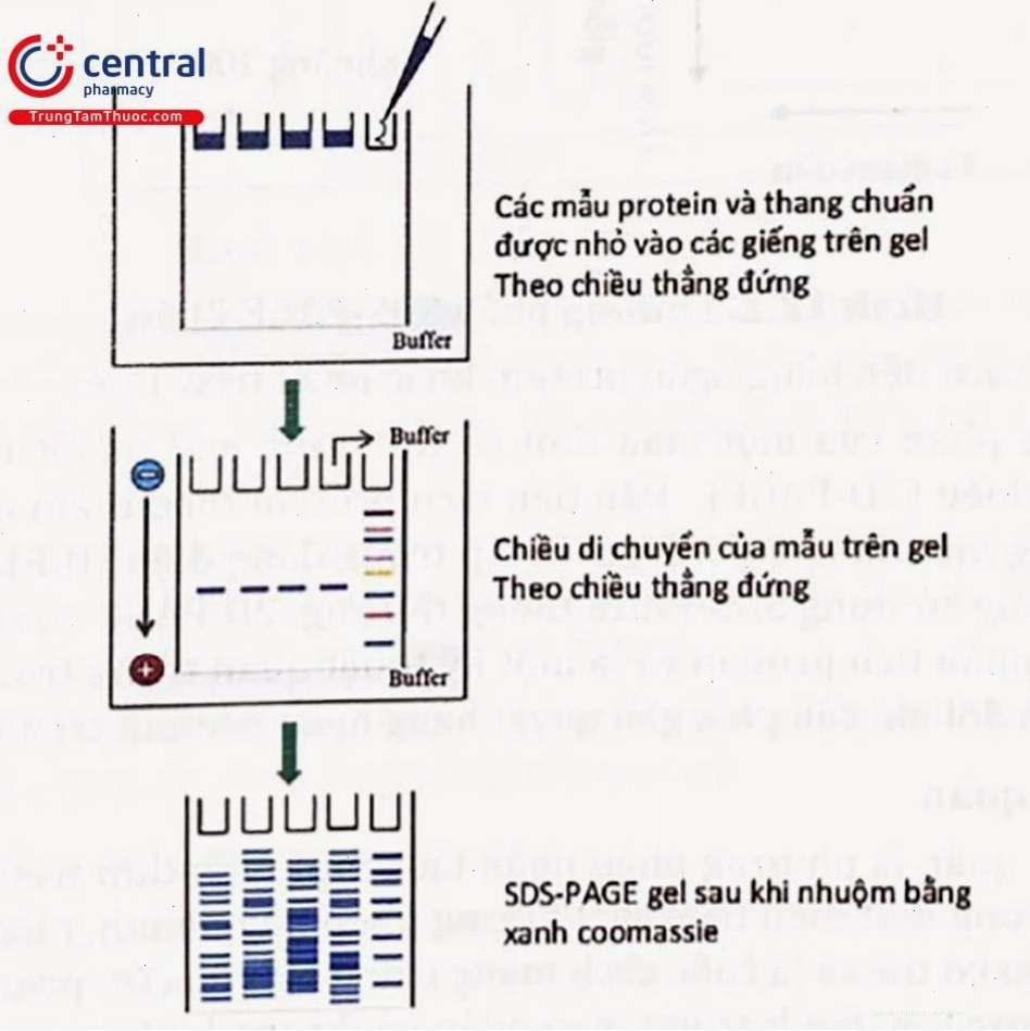 Minh họa hình ảnh điện di trên gel