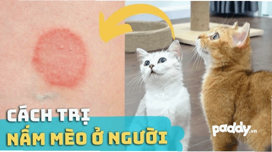 Minh họa tình trạng da nhiễm nấm mèo ở người