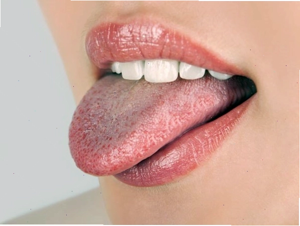 Một số loại thuốc điều trị nấm lưỡi phổ biến trên thị trường