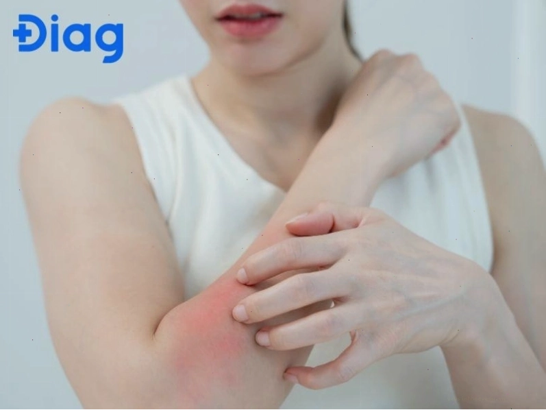 Ngứa khắp người có thể do bệnh da liễu, bệnh nội tạng hoặc các trường hợp không rõ nguyên nhân.