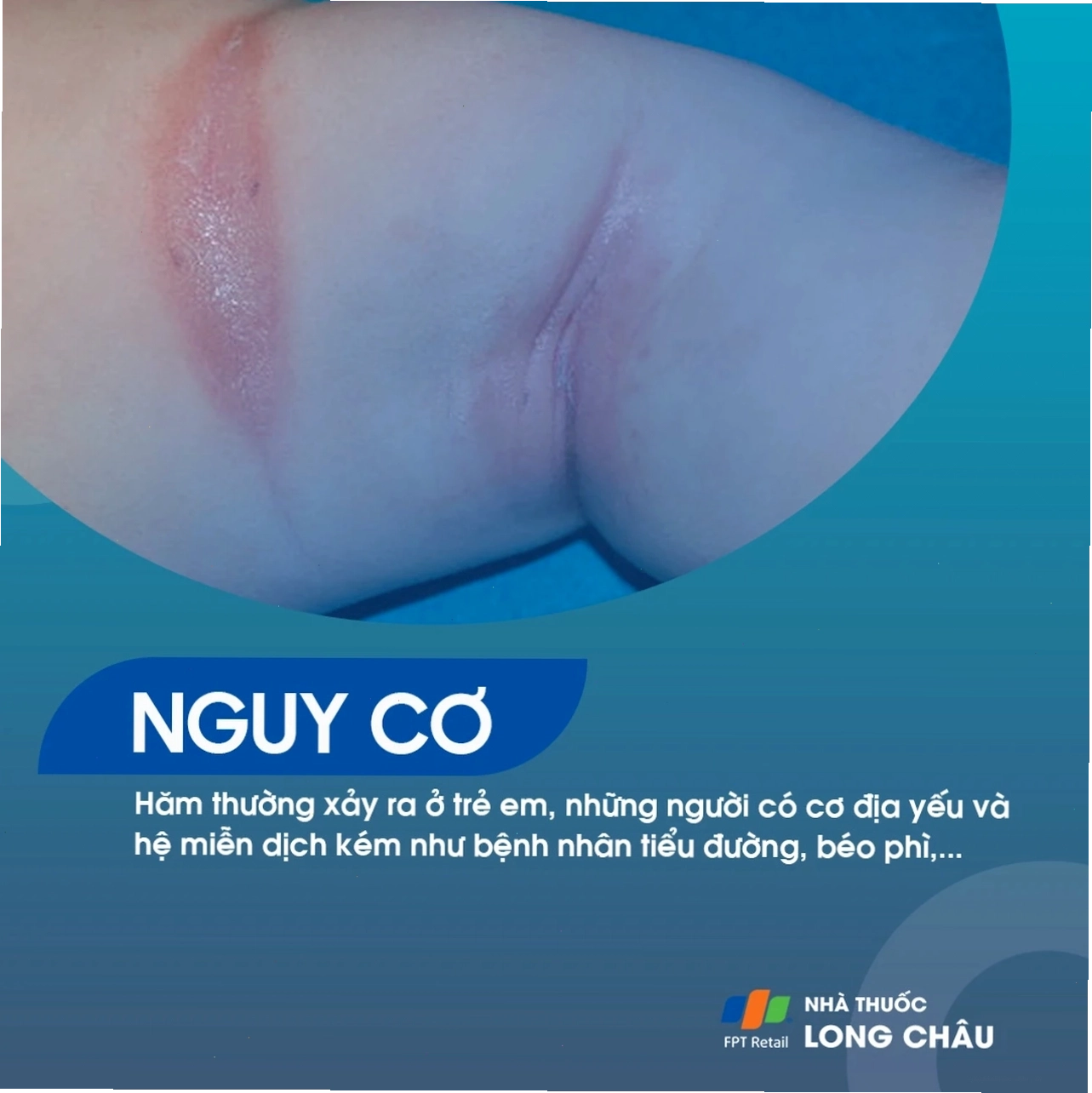 Người bệnh trao đổi với bác sĩ về tình trạng hăm da