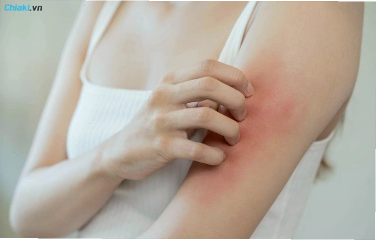 Người lớn bị hăm da ở vùng mông do ẩm ướt và ma sát