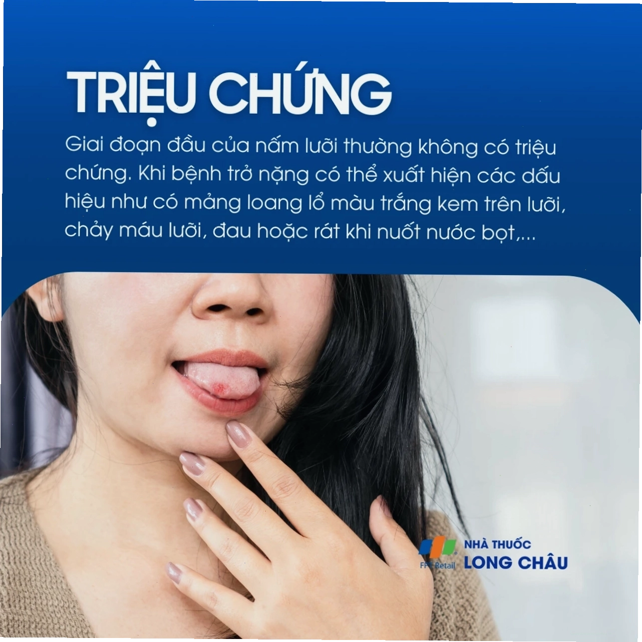 Người lớn đang súc miệng để điều trị nấm lưỡi