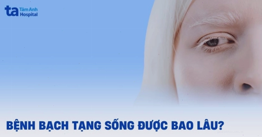 Người mắc bệnh bạch tạng có tuổi thọ tương đương người bình thường nếu được chăm sóc tốt