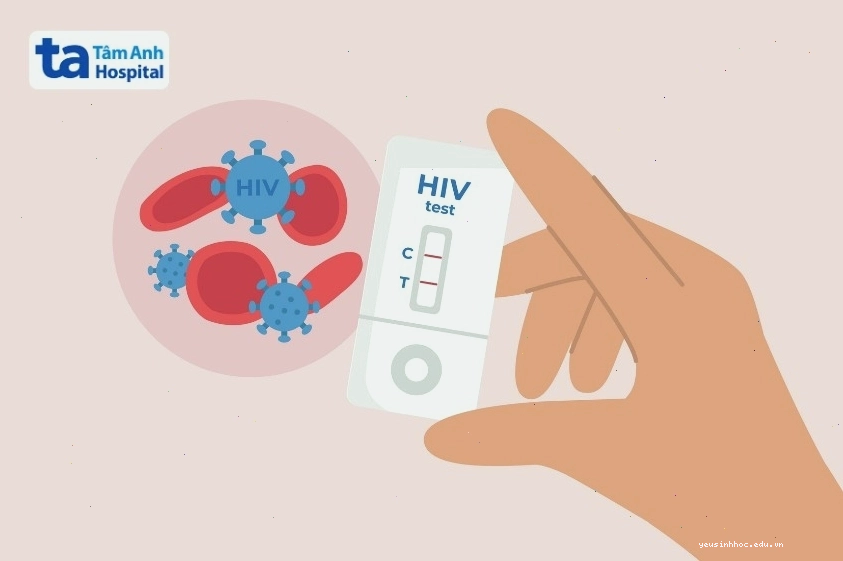 Người nhiễm HIV có nguy cơ cao mắc xuất huyết giảm tiểu cầu miễn dịch