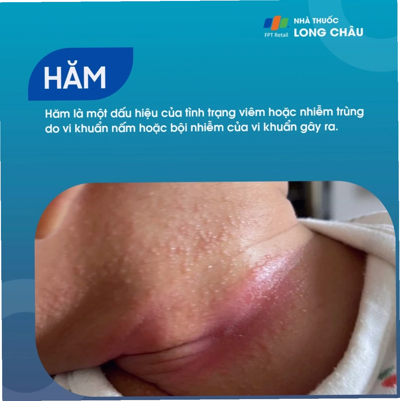 Người phụ nữ đang vệ sinh cá nhân vùng kín sạch sẽ