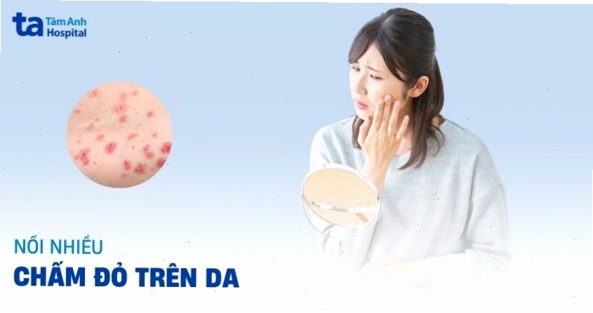 Nổi chấm đỏ trên da: Nguyên nhân, dấu hiệu và cách điều trị